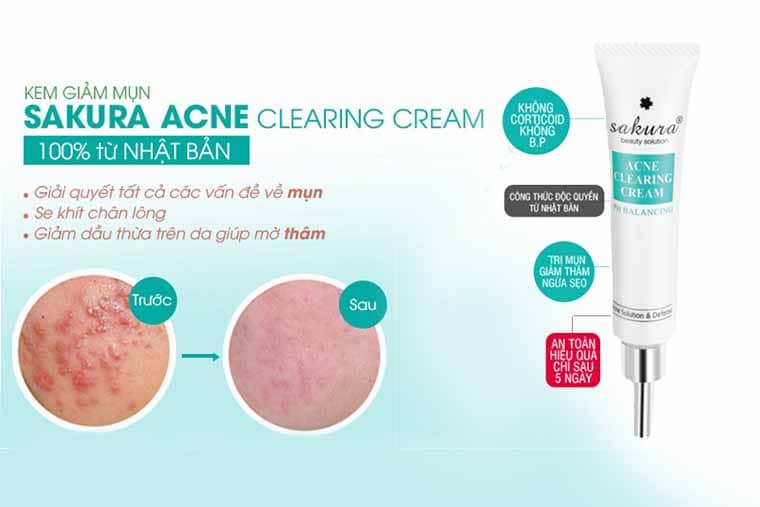 Kem trị mụn Sakura Acne