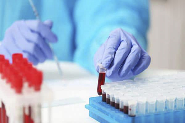 Xét nghiệm máu là một trong những phương pháp chẩn đoán phổ biến Xét nghiệm máu là một trong những phương pháp chẩn đoán phổ biến